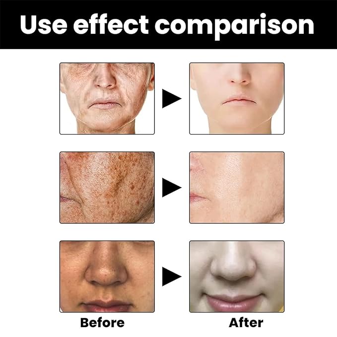 Melanin Repair – (suero reparador de melanina)