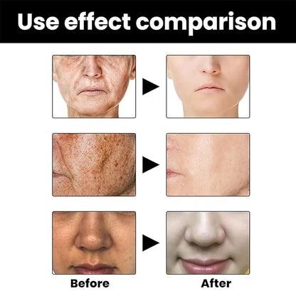 Melanin Repair – (suero reparador de melanina)