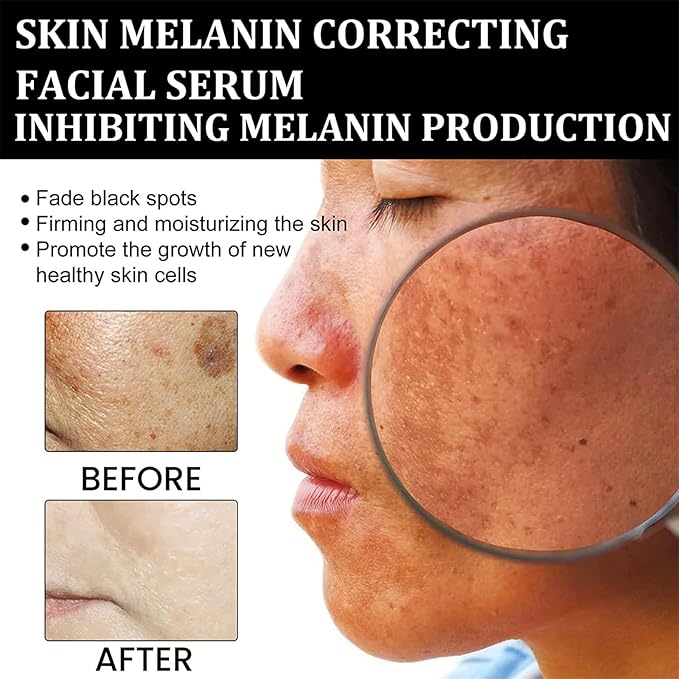 Melanin Repair – (suero reparador de melanina)